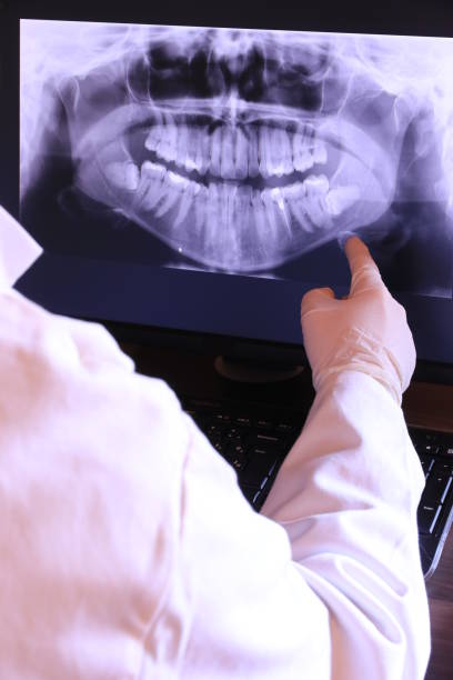 Best Emergency Tooth Extraction in Heflin, AL